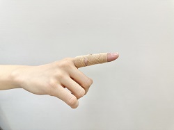 突き指炎治療イメージ