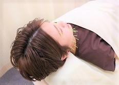 アレルギー性鼻炎（花粉症）治療イメージ