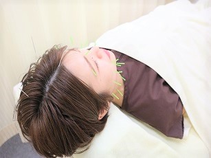 不眠症治療イメージ