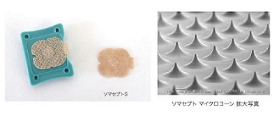 腰痛鍼灸イメージ