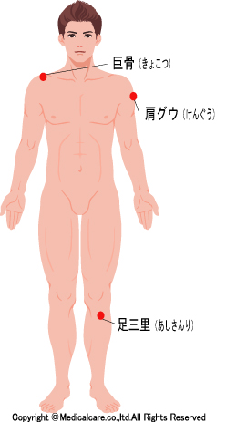 巨骨、肩髃（けんぐう）、足三里