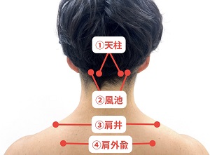 肩こり鍼灸イメージ