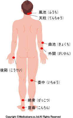 風池、天柱、曲池、外関、後谿、委中、絶骨、崑崙