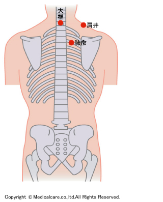 肩井、大椎、肺兪