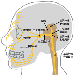 三叉神経痛イメージ