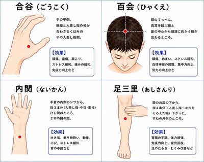 線維筋痛症